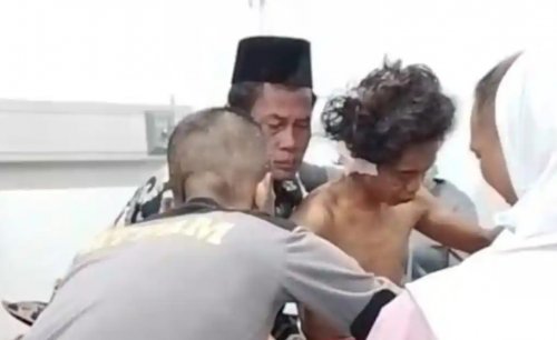 Pekerja alat berat yang diserang Harimau Sumatra di Teluk Lanus, Siak sudah mendapat perawatan medis (foto/tribunpku)